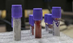 Kan testiyle her üç kanserden ikisi tespit ediliyor